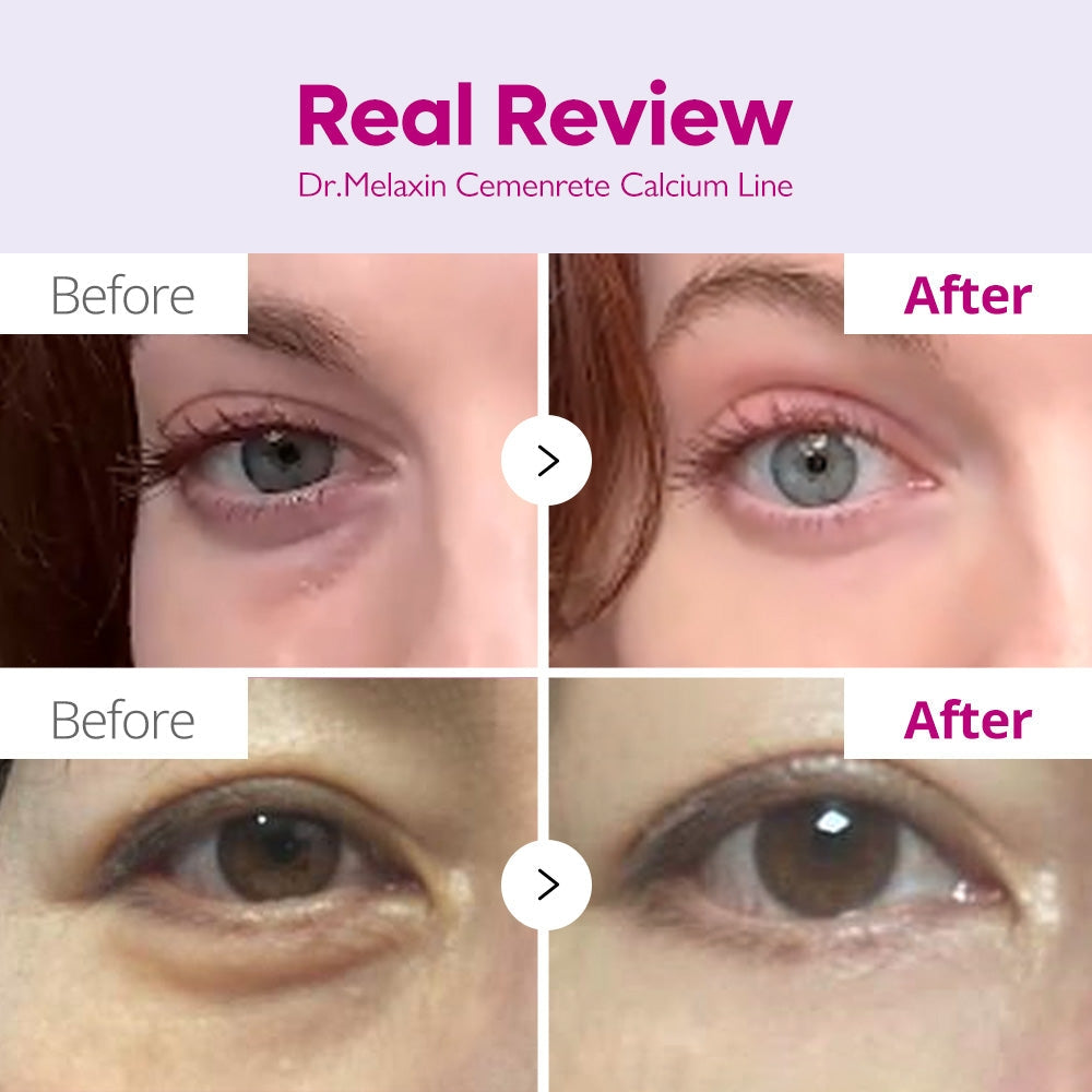 Dr. Melaxin Cemenrete Ultimate Calcium Eye Care Set – Multi Balm, Calcium Eye Patches & Complete Eye Care Line for Firming, Brightening & Anti-Aging Under-Eye Treatment