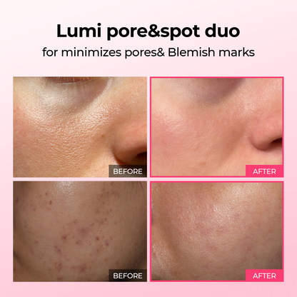 [TikTok Bestseller] Lumi firm & lift Duo