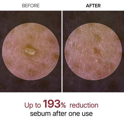 Peel Shot Glow Rice Ampoule Duo & Kojic Acid Duo