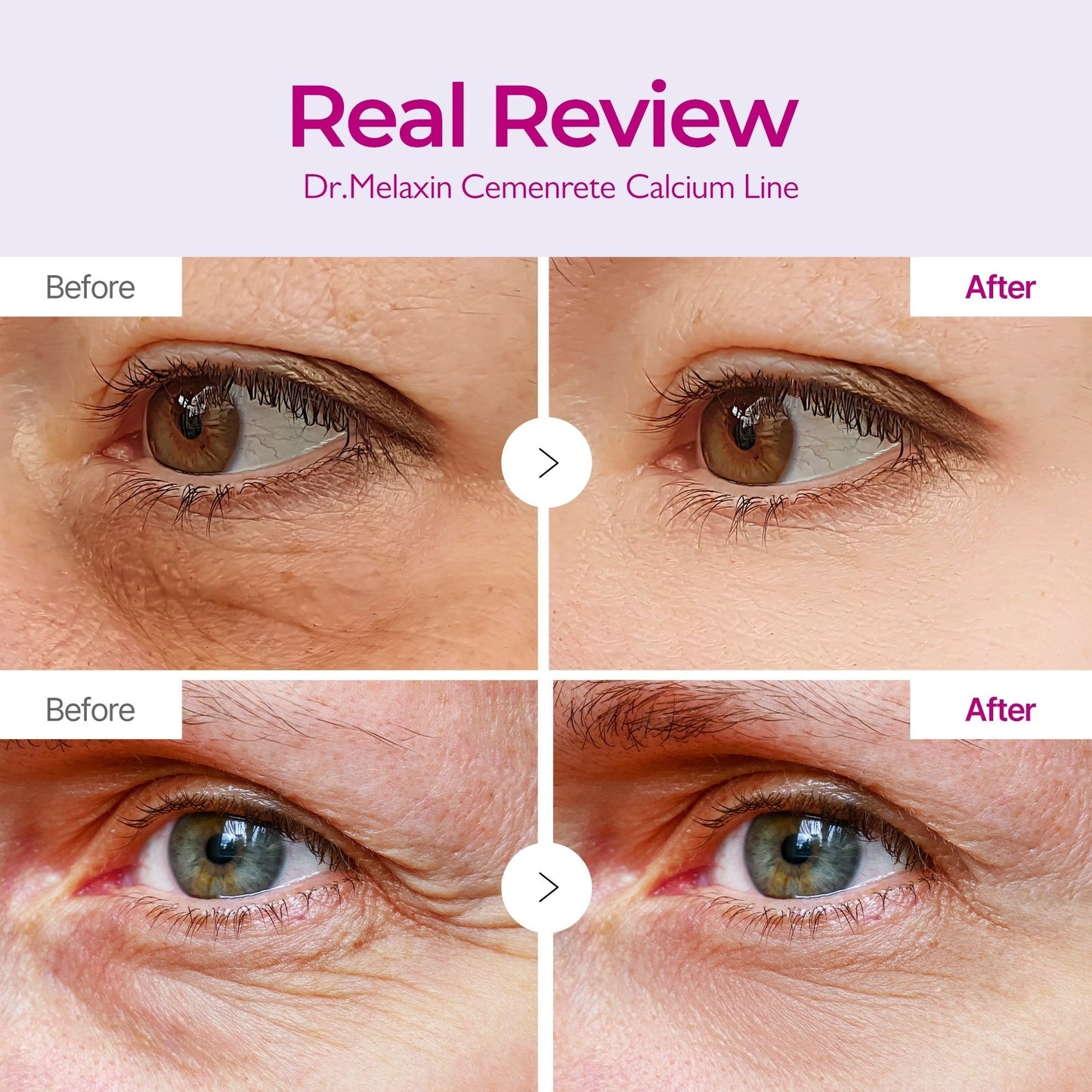 Calcium Volume Eye Patch 60ea